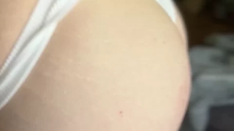 Slim White Girl with Stretch Marks on Butt