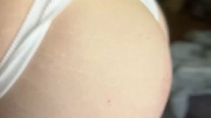 Slim White Girl with Stretch Marks on Butt